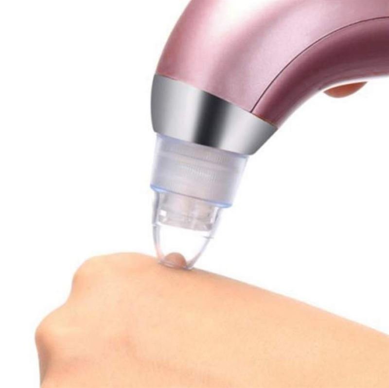 SKIN XN - 8030 Blackhead Vacuum - Effective Rechargeable Blackhead Remover - | Fashiongirl